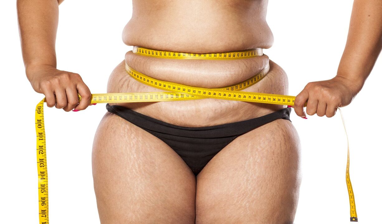 Overweight and weight loss using zxcvbnmqwert